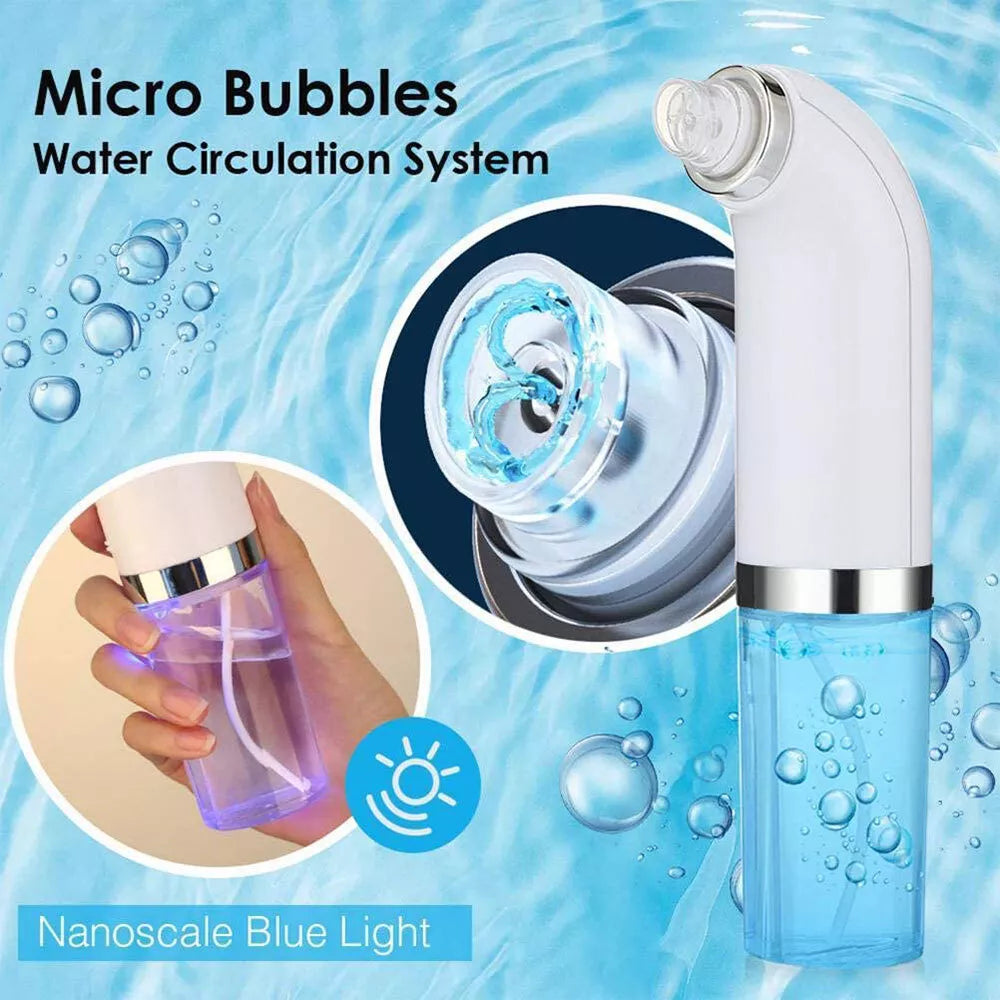 Professional Nose Blackhead Remover Vacuum - Deep Cleansing with Suction Technology