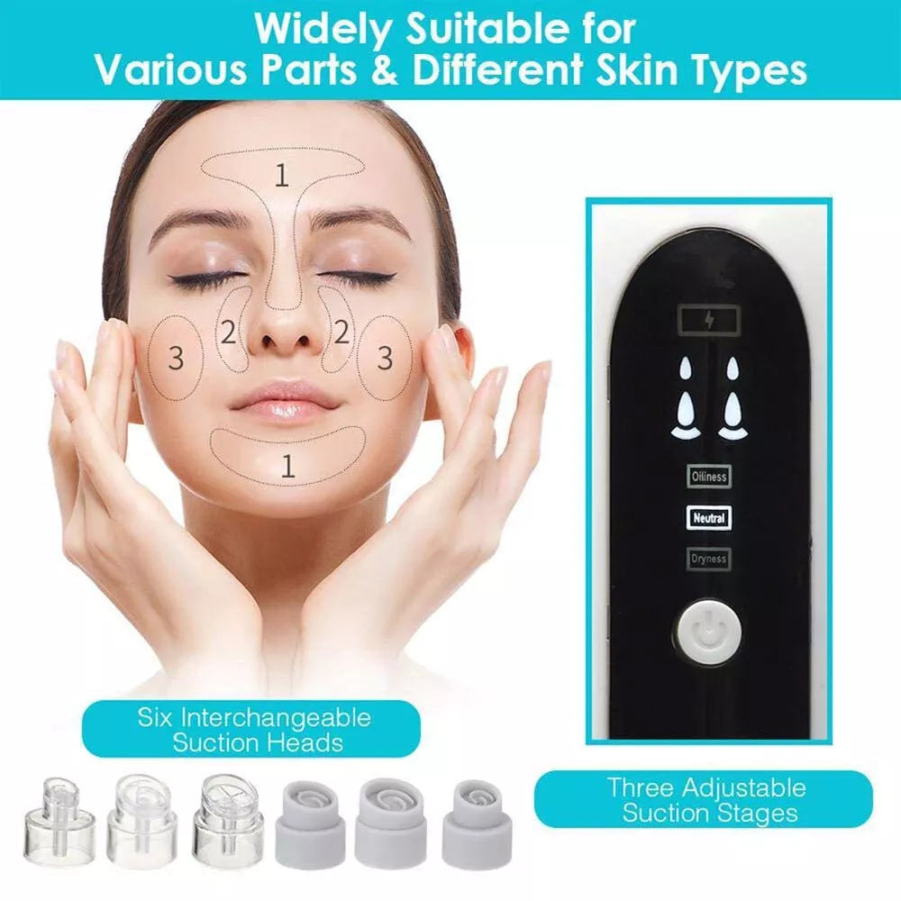 Professional Nose Blackhead Remover Vacuum - Deep Cleansing with Suction Technology